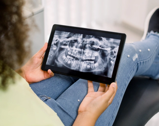 Dental X-Rays Premier Smiles of Bellevue